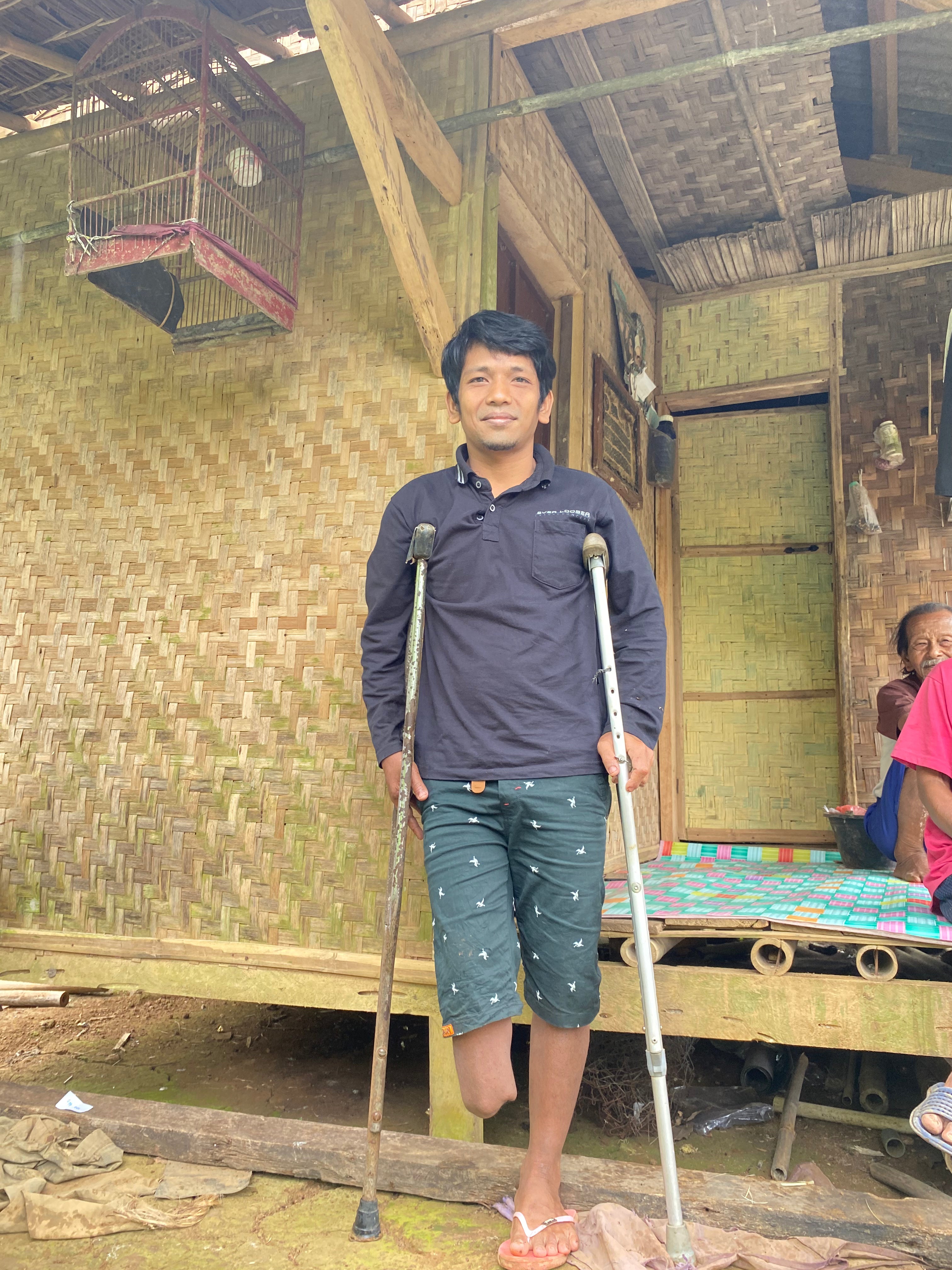 3 Prostheses – Bogor, Indonesia