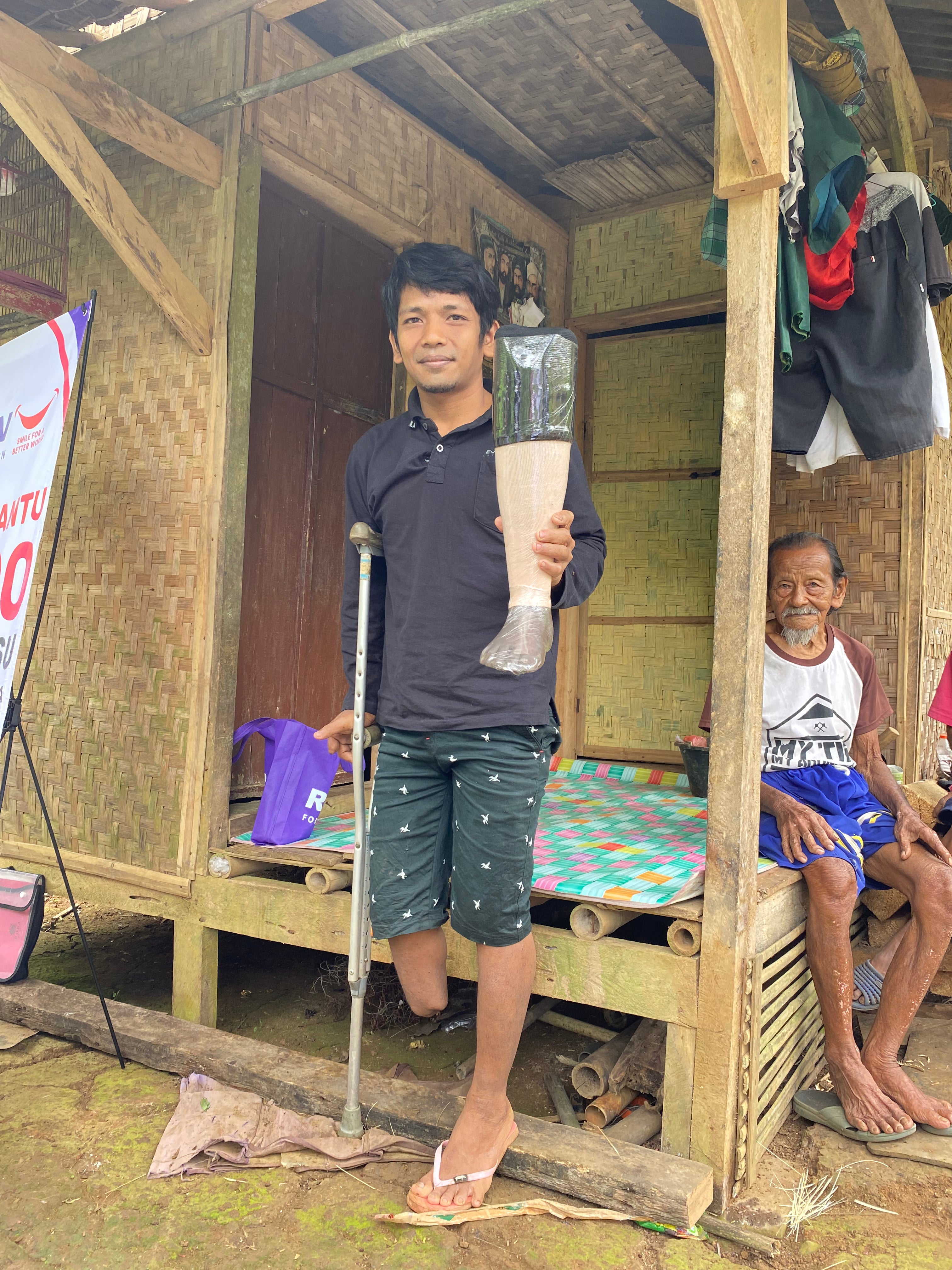 3 Prostheses – Bogor, Indonesia