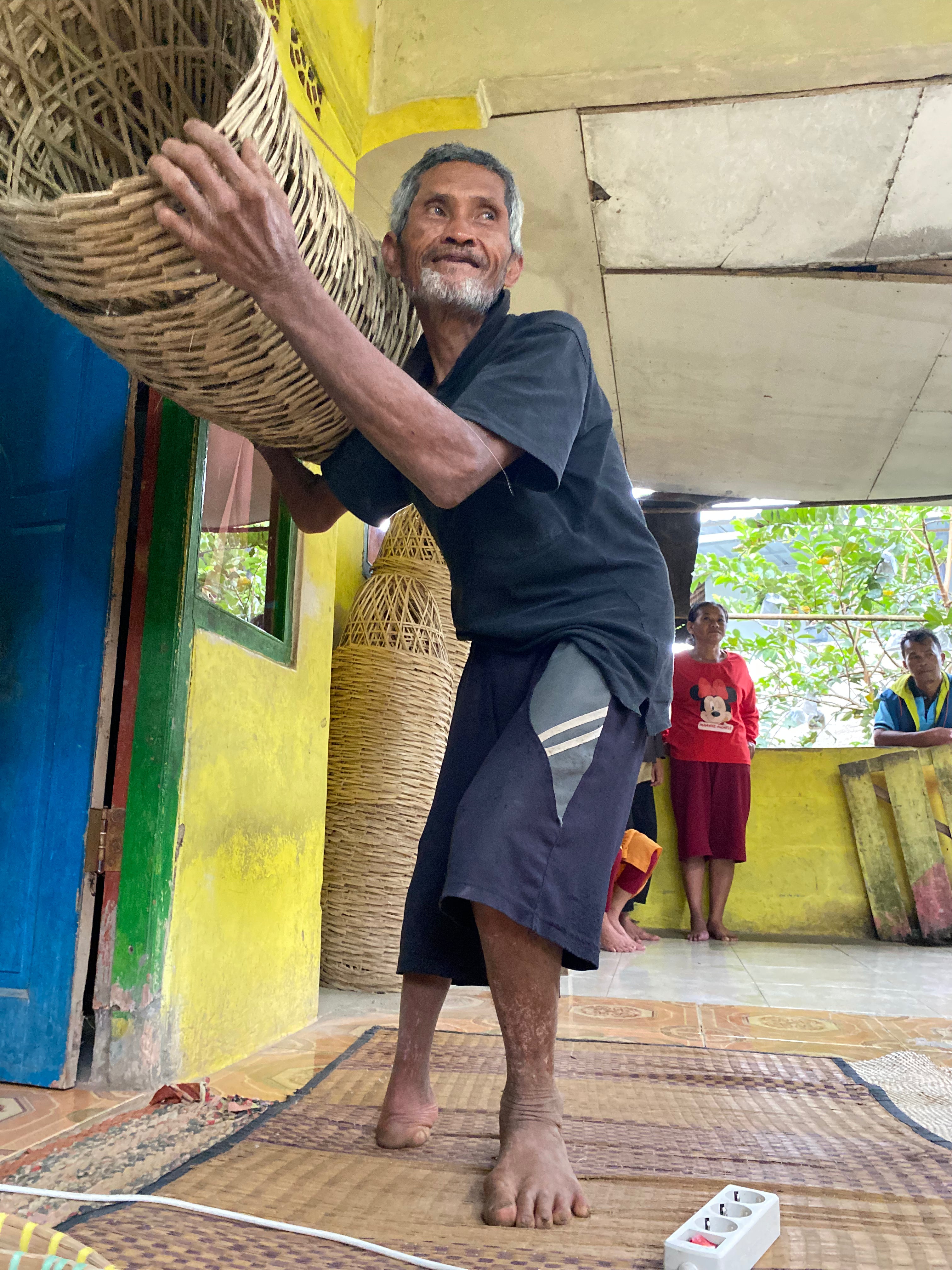 3 Prostheses – Bogor, Indonesia