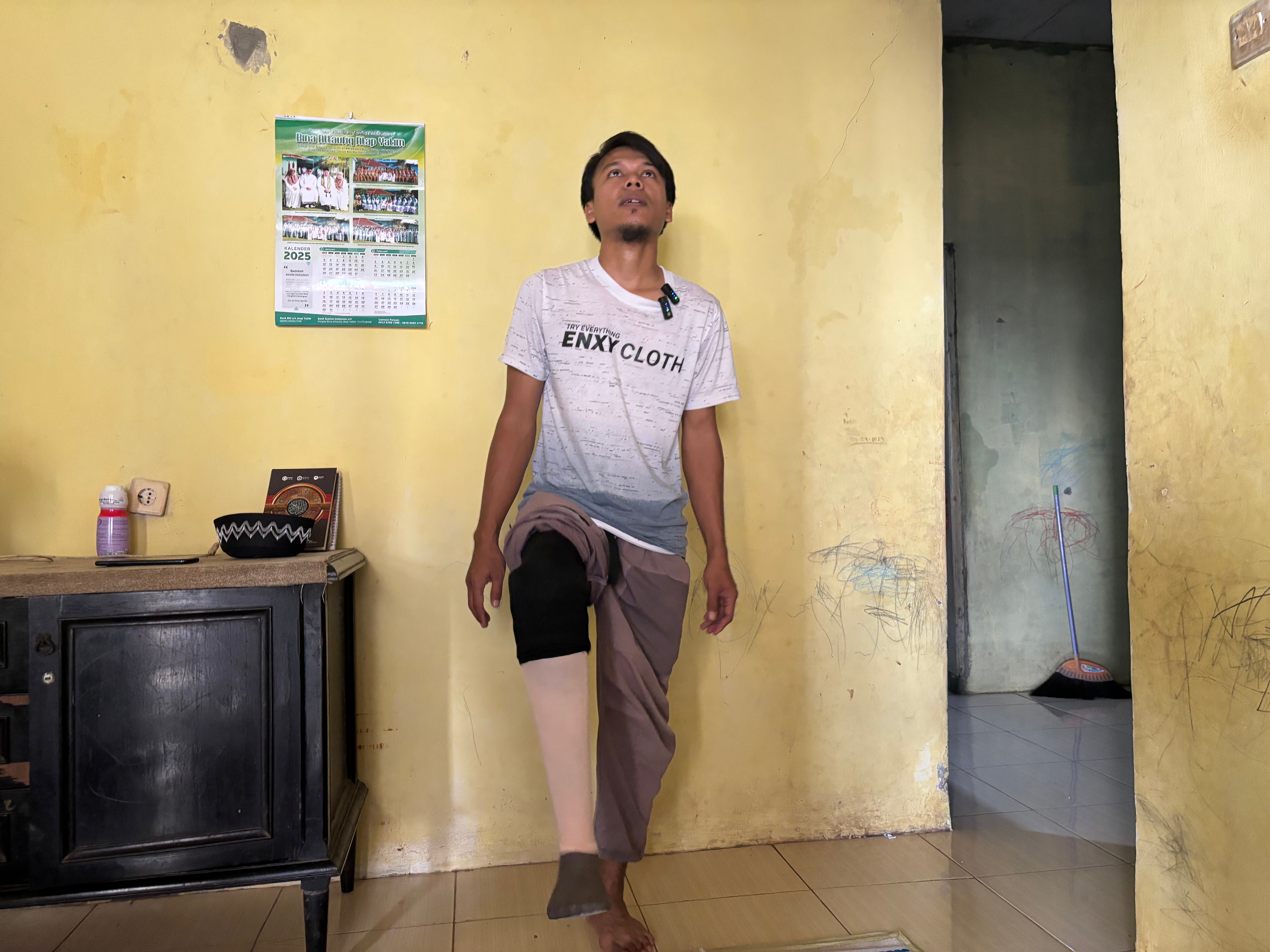 3 Prostheses – Bogor, Indonesia