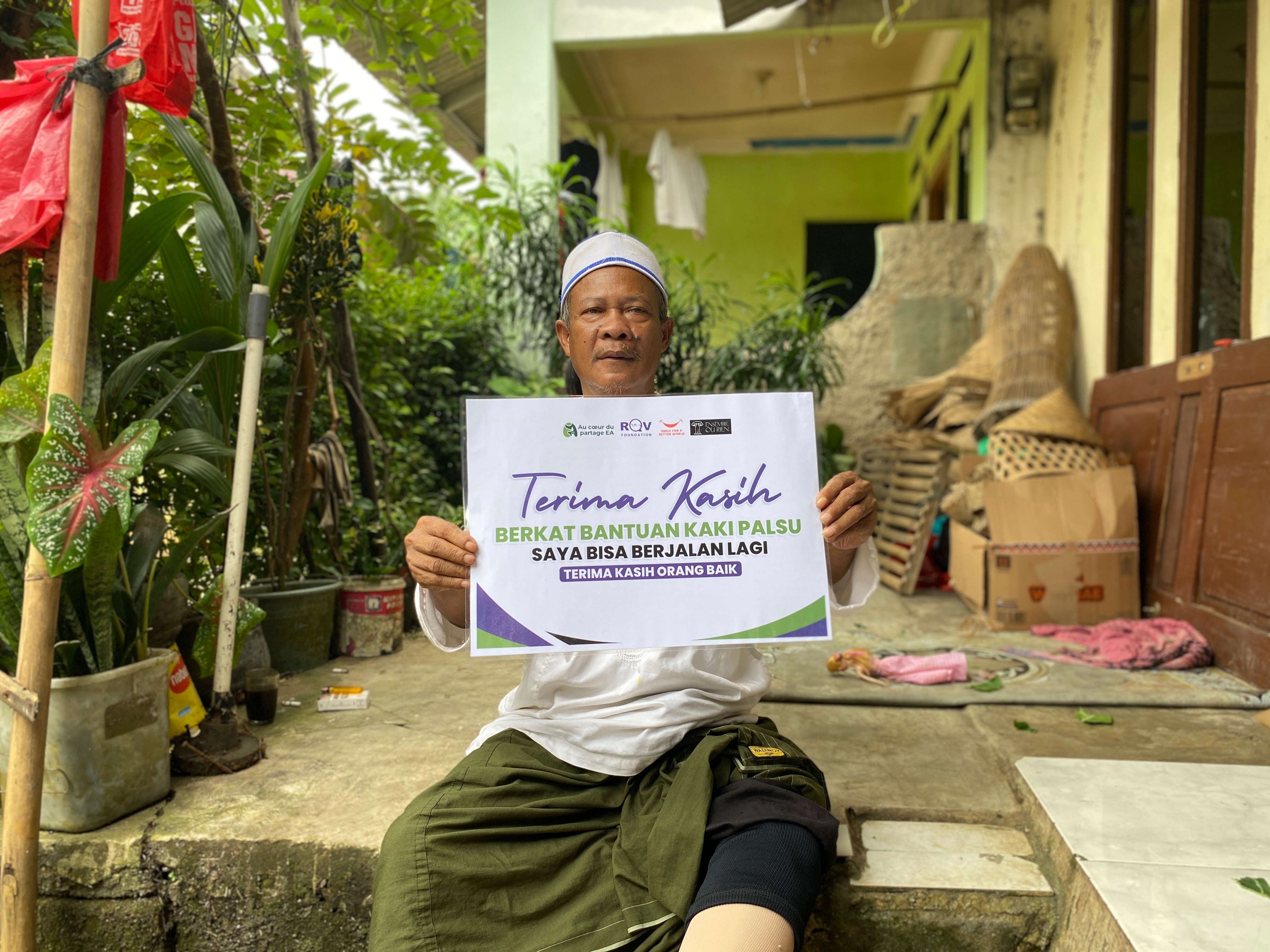 3 Prostheses – Bogor, Indonesia